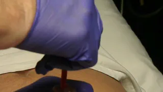 Джейк первый катетера