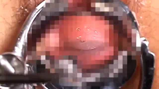 Туалет матки пить мочу